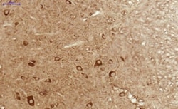 AKT3 Antibody, Novus Biologicals 25 &mu;L; Unlabeled:Antibodies, Polyclonal